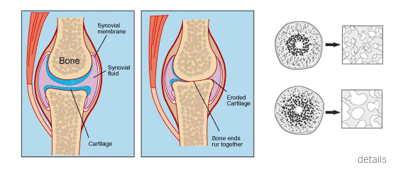 Medical Illustration